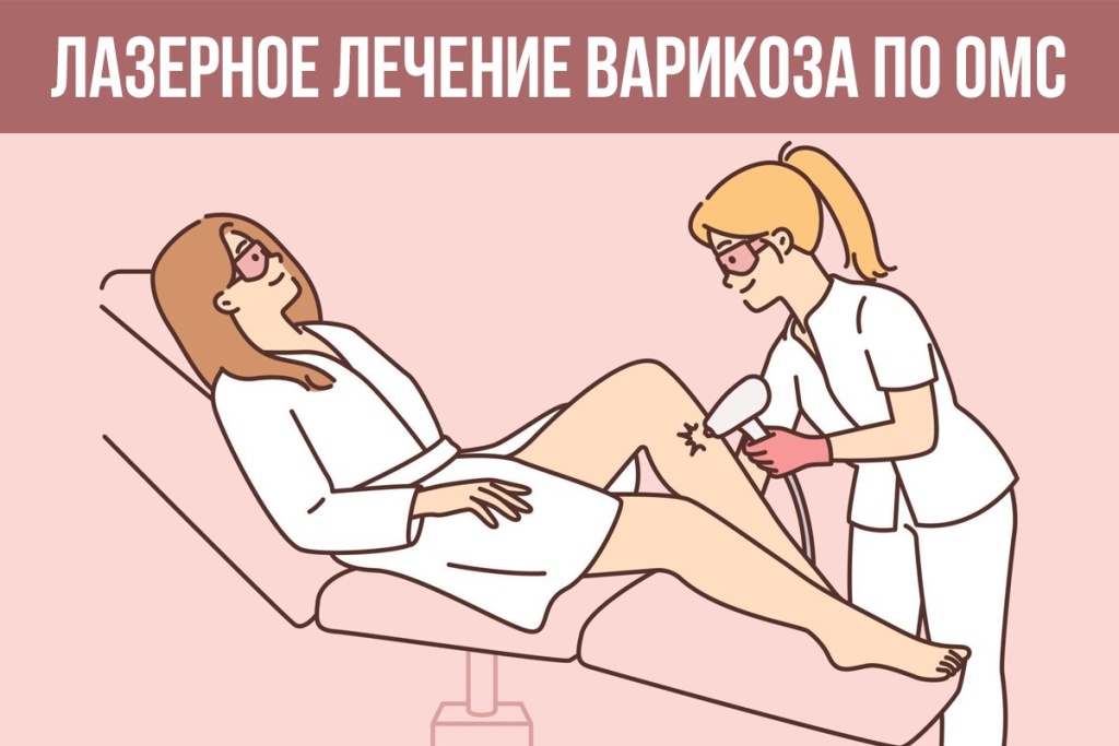 варикоз по ОМС 1.jpg
