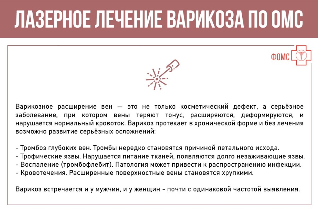 варикоз по ОМС 2.jpg